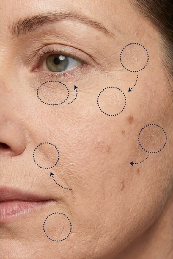Dull-looking skin