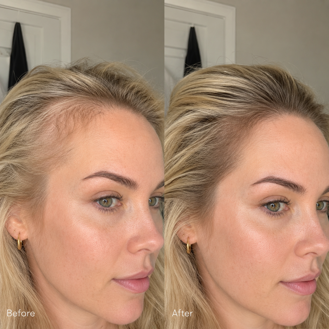 Hair Growth Booster with PDRN 15ml