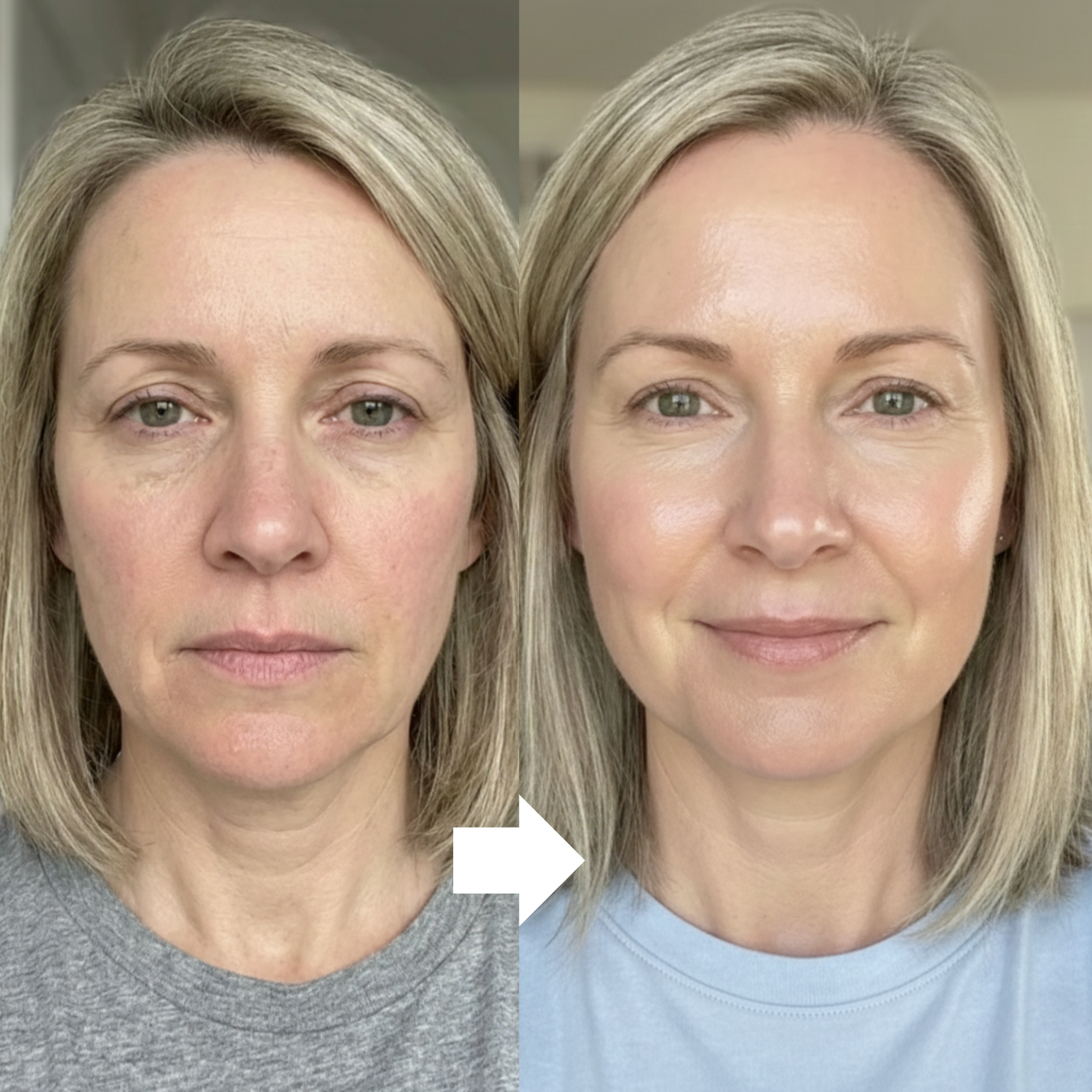 HAUA PDRN Sérum Orb