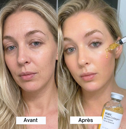 Lift à la soie dorée aux peptides