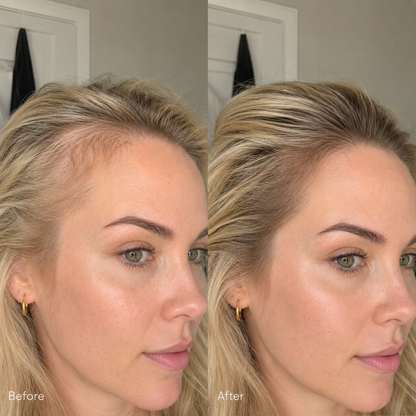 Hair Growth Booster with PDRN 15ml