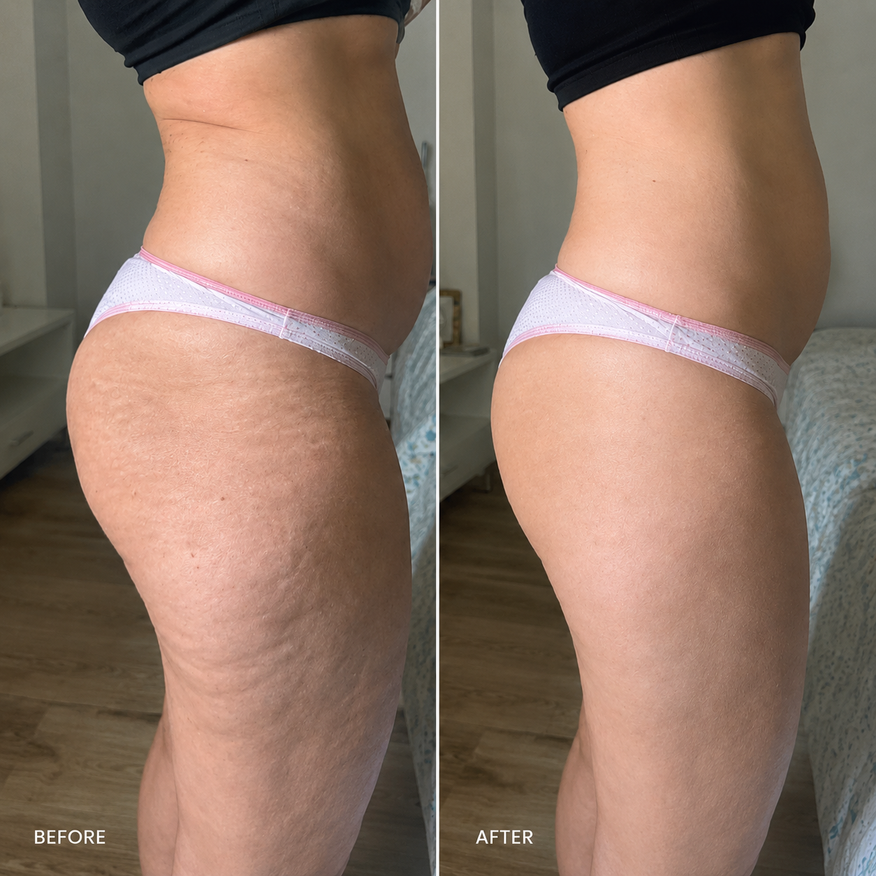 EMS Body Revolution™