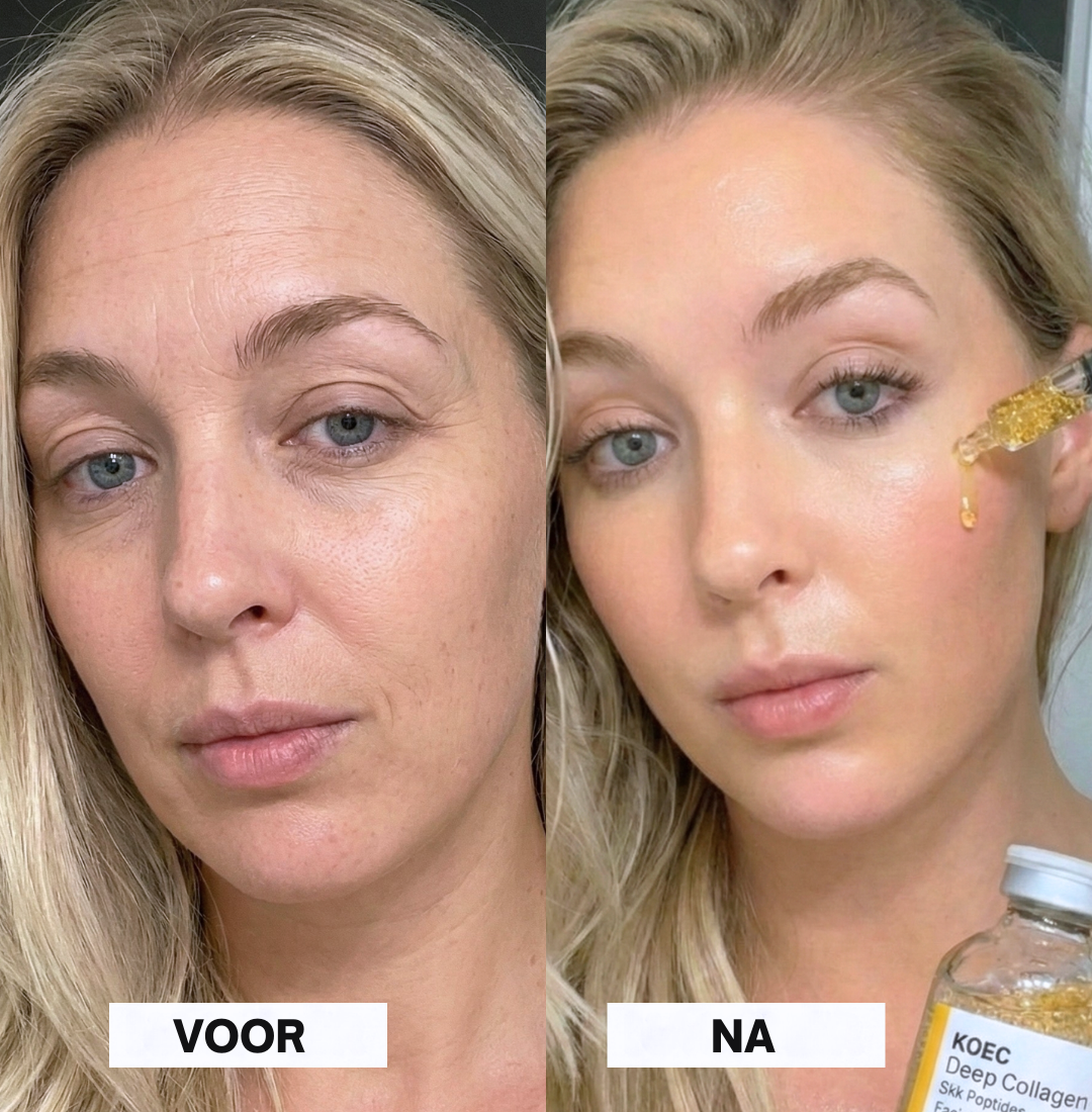 Lift met gouden zijde en peptiden