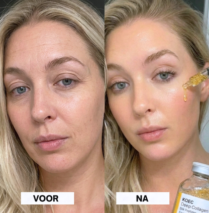 Lift met gouden zijde en peptiden