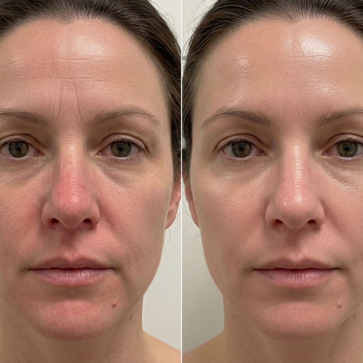 Lift à la soie dorée aux peptides