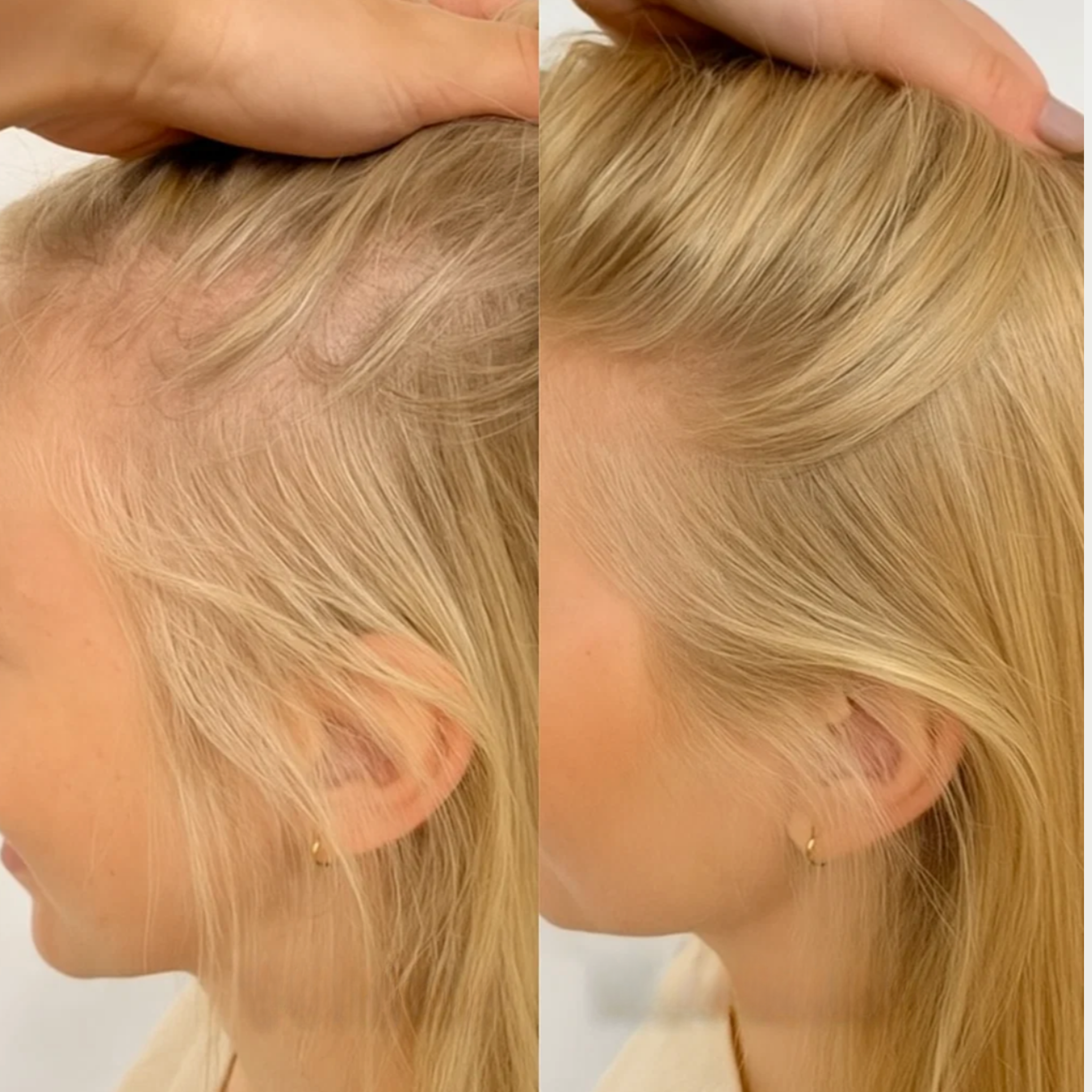 PDRN haargroei booster 15 ml